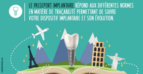 https://selarl-leclercq-patrice.chirurgiens-dentistes.fr/Le passeport implantaire