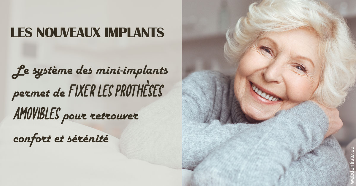 https://selarl-leclercq-patrice.chirurgiens-dentistes.fr/Les nouveaux implants 1