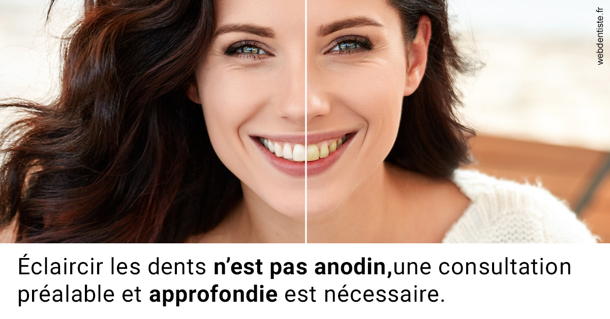 https://selarl-leclercq-patrice.chirurgiens-dentistes.fr/Le blanchiment 2