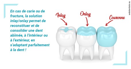 https://selarl-leclercq-patrice.chirurgiens-dentistes.fr/L'INLAY ou l'ONLAY