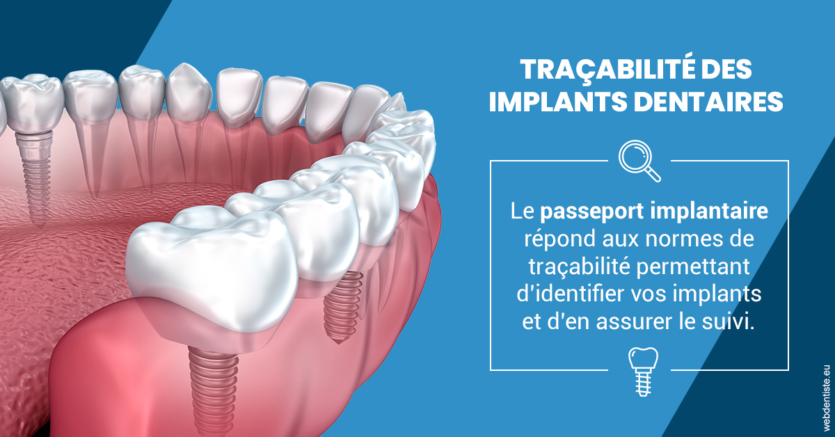 https://selarl-leclercq-patrice.chirurgiens-dentistes.fr/T2 2023 - Traçabilité des implants 1