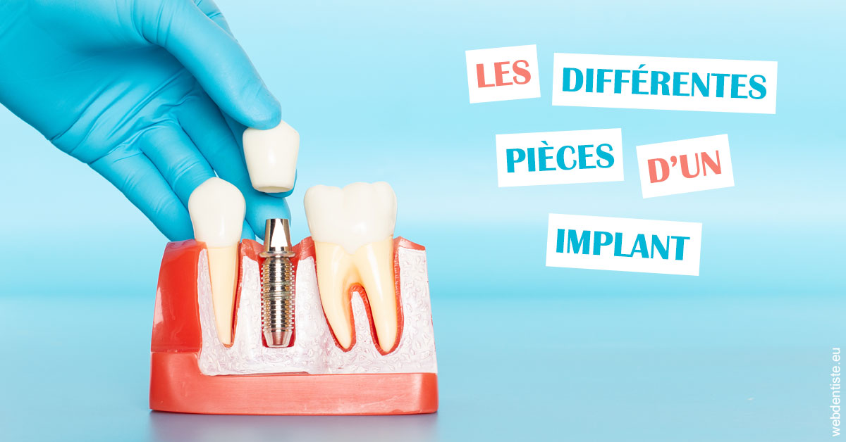 https://selarl-leclercq-patrice.chirurgiens-dentistes.fr/Les différentes pièces d’un implant 2