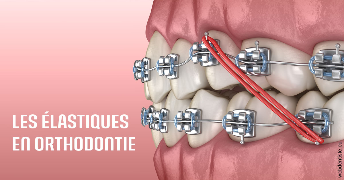 https://selarl-leclercq-patrice.chirurgiens-dentistes.fr/Elastiques orthodontie 2