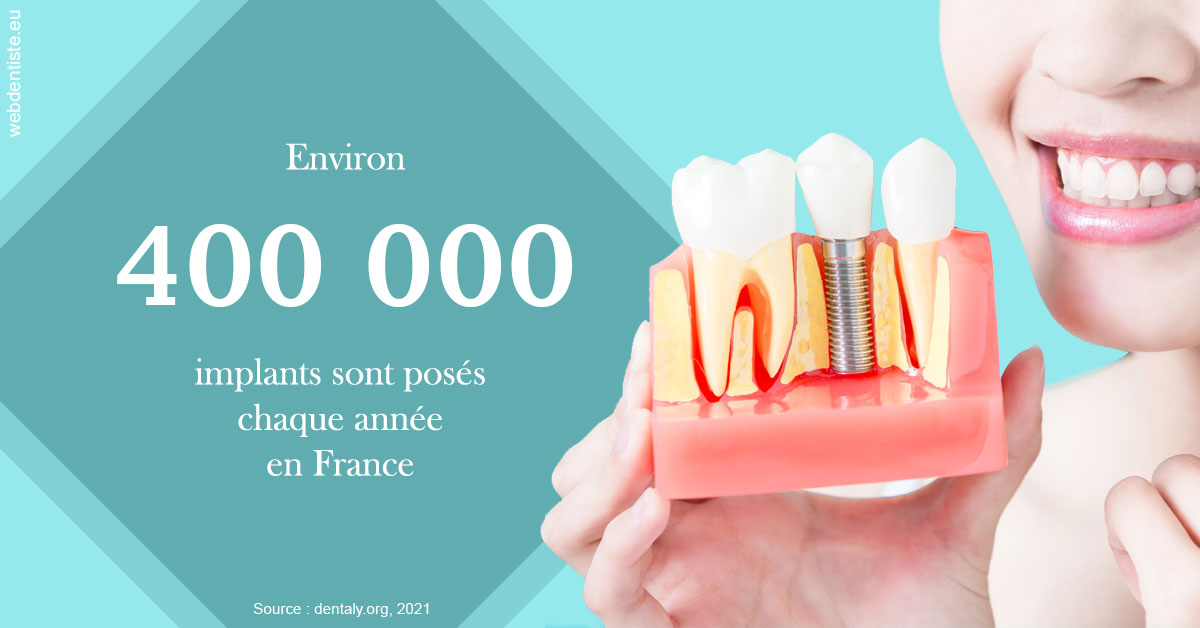 https://selarl-leclercq-patrice.chirurgiens-dentistes.fr/Pose d'implants en France 2
